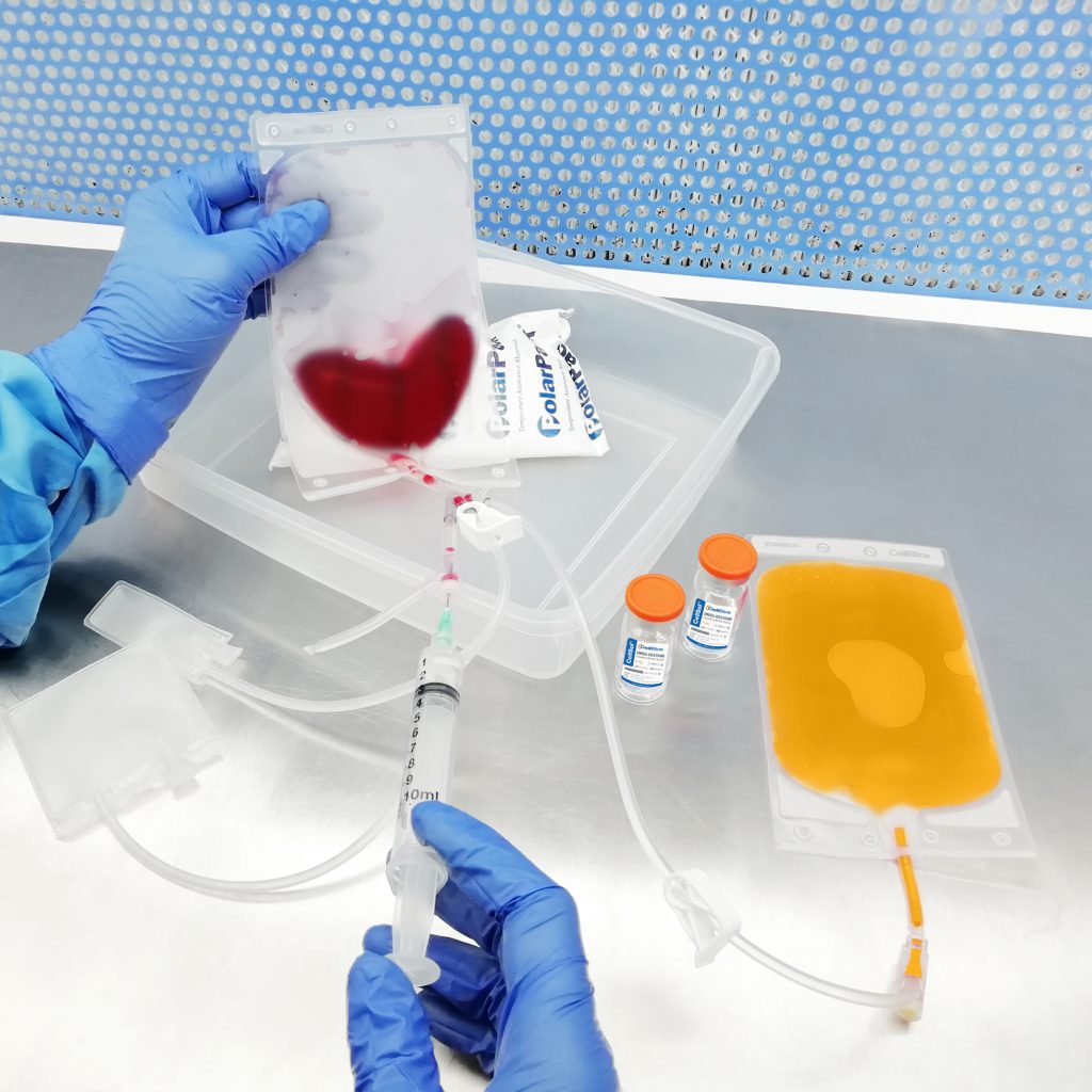 Cellbios provides transfer freezing bags for red blood cell depletion and Volume reduction to acquire concentrated cord blood stem cells to treat various diseases.